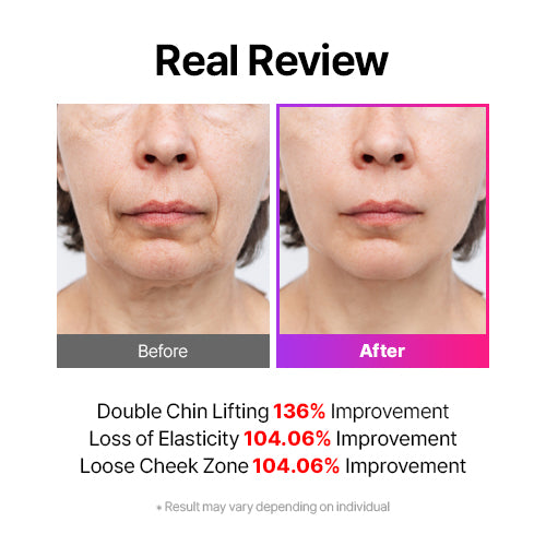 EMS V-Thera (WHITE) by Mommy care