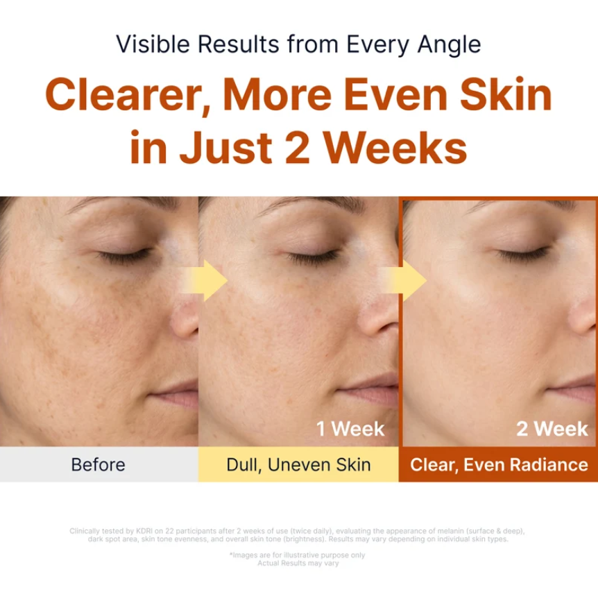 Kojic Acid Niacinamide Brightening Ampoule sbedt by Sungboon Editor