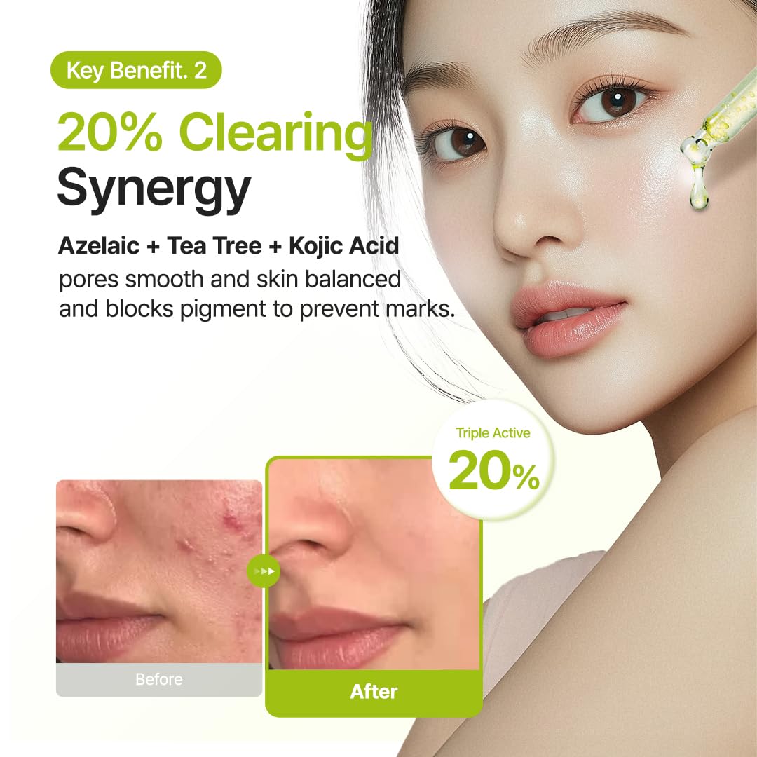 Azelaic Acid 10 Kojic Azulene Serum by Purito – koreancosmetic.cy